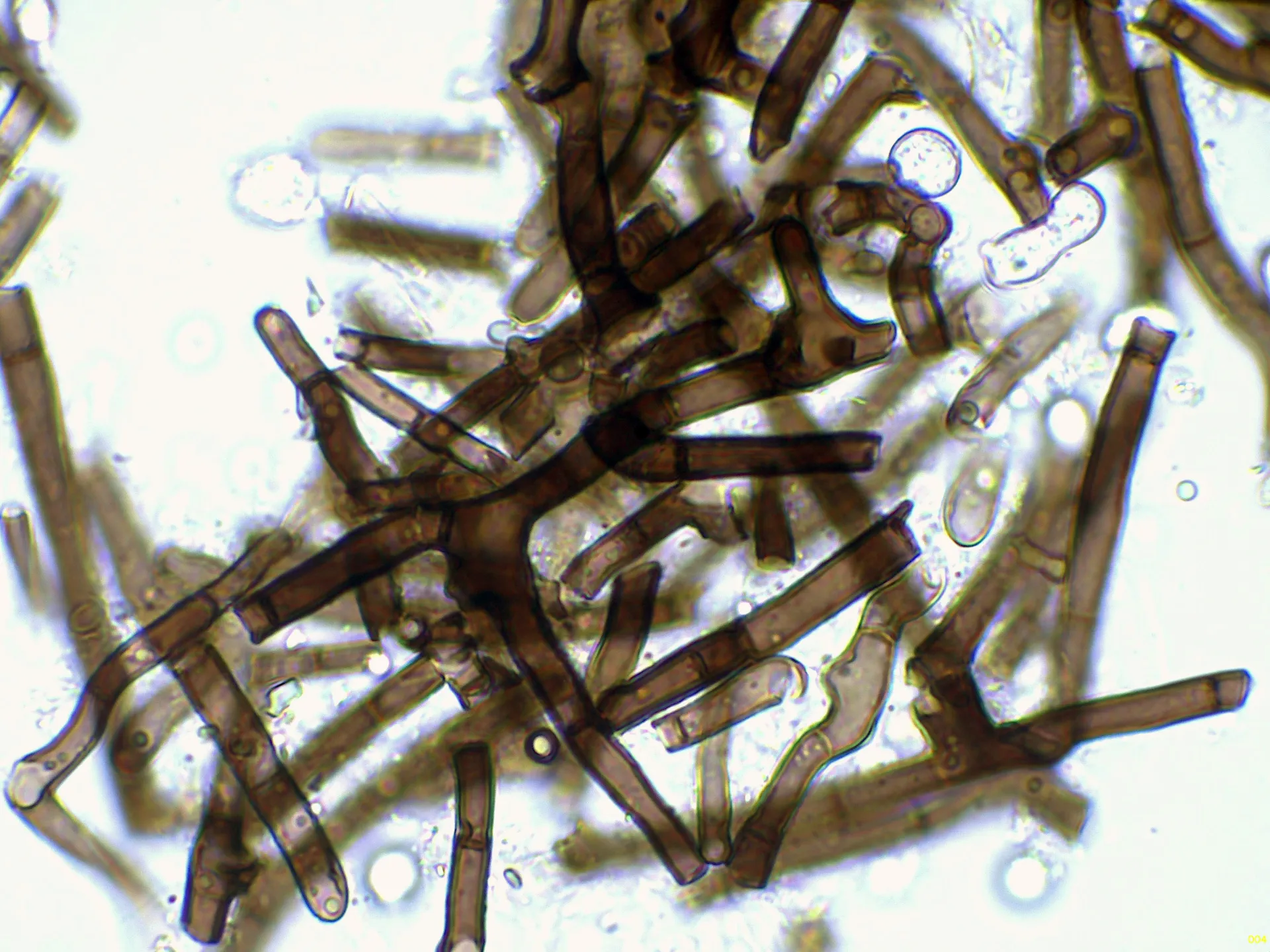 Microscopía de Rosellinia corticium - 11 - Hifas agua-004